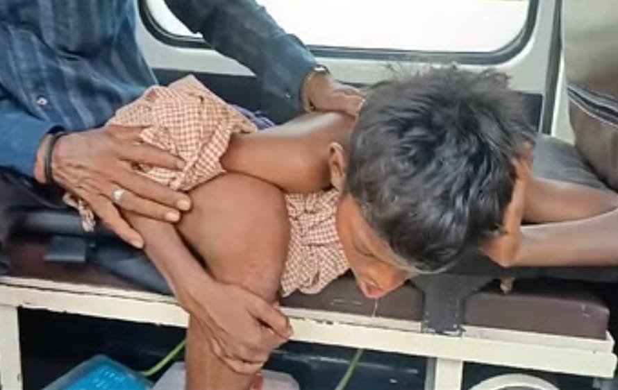 दोस्तों के साथ तालाब में नहाते वक्त मुंह में घुसी मछली, करना पड़ा ऑपरेशन