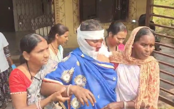 स्कूल में खाना बनाते समय कुकर फटने से रसोइया का चेहरा जल गया