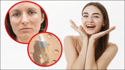 सर्दियों में पाएं मक्खन-सी मुलायम त्वचा: ग्लिसरीन में मिलाएं नींबू और गुलाबजल