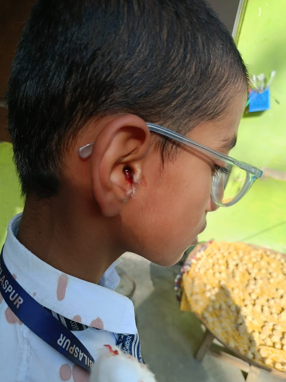 लोयोला स्कूल में शिक्षक की क्रूरता का शिकार बना छात्र