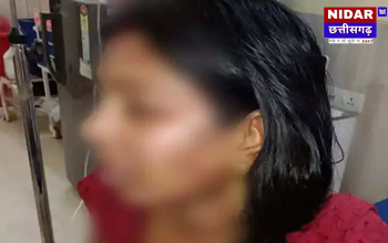 250 रुपए के लिए पति की हैवानियत, पत्नी पर झलका दी गर्म दाल