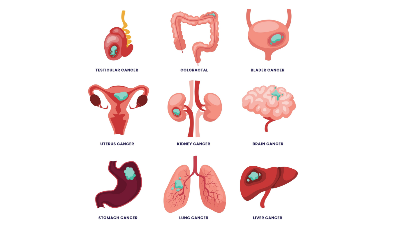 कैंसर अब लाइलाज नहीं?