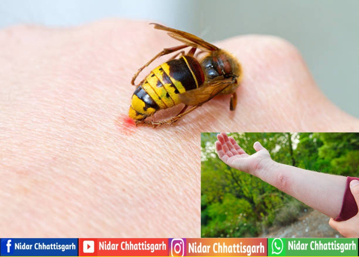 ततैया काट ले तो घबराएं नहीं! दर्द, जलन और सूजन से तुरंत राहत देंगे ये 5 अचूक घरेलू नुस्खे