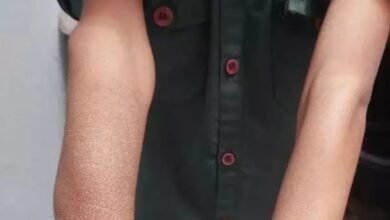 Utai Medical Negligence: WhatsApp पर सलाह लेकर किया मासूम का इलाज, डॉक्टर की लापरवाही से बिगड़ी बच्चे की हालत!