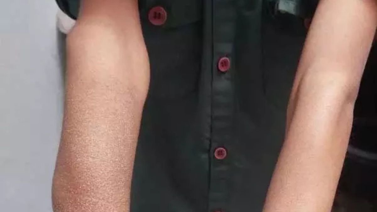 Utai Medical Negligence: WhatsApp पर सलाह लेकर किया मासूम का इलाज, डॉक्टर की लापरवाही से बिगड़ी बच्चे की हालत!