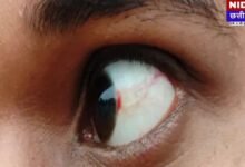 छत्तीसगढ़ के दुर्ग में गुरु-शिष्य परंपरा शर्मसार: मोबाइल मिलने पर शिक्षकों ने छात्रों को बेरहमी से पीटा, प्राइवेट पार्ट पर मारी लात