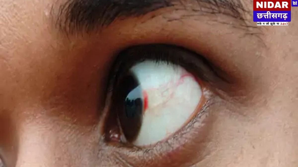 छत्तीसगढ़ के दुर्ग में गुरु-शिष्य परंपरा शर्मसार: मोबाइल मिलने पर शिक्षकों ने छात्रों को बेरहमी से पीटा, प्राइवेट पार्ट पर मारी लात