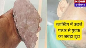 Cement Plant Blasting Accident: लापरवाही ने ली मासूम की मुस्कान, युवक का जबड़ा टूटा